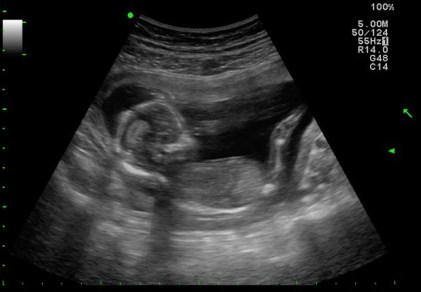 252727_10150207908686730_5045481_n